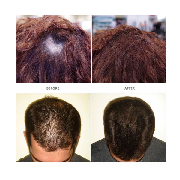 SureThik Hair Fibers 15g