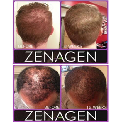Zenagen Revolve Treatment Men Shampoo 6oz